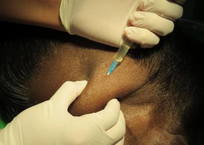 Pharmacological Models