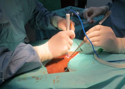 Cardiovascular Models